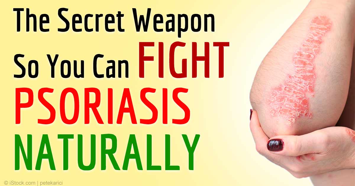 The Secret Weapon To Fight Psoriasis Naturally Ramsey Nj Patch