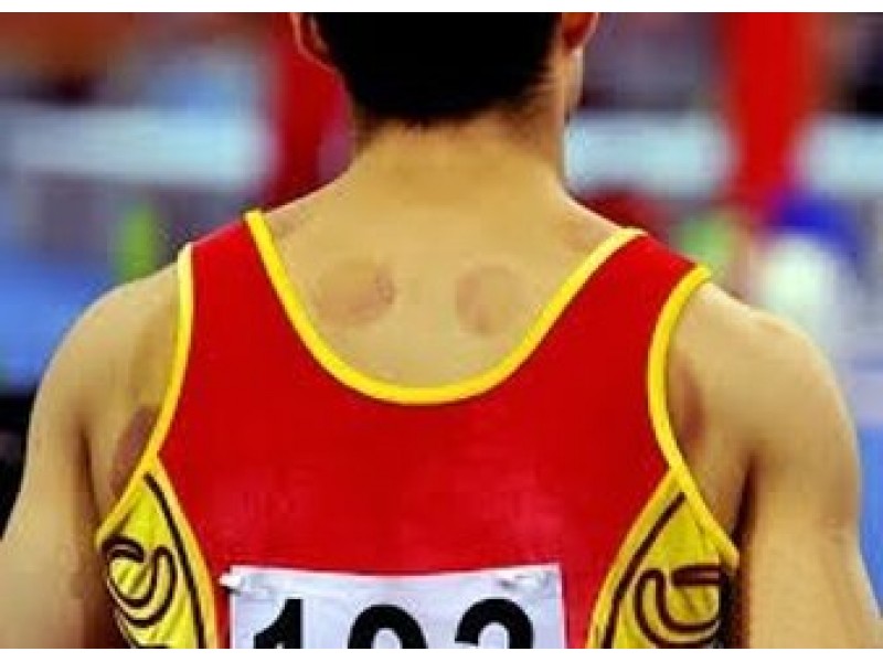 Image result for cupping therapy athletes