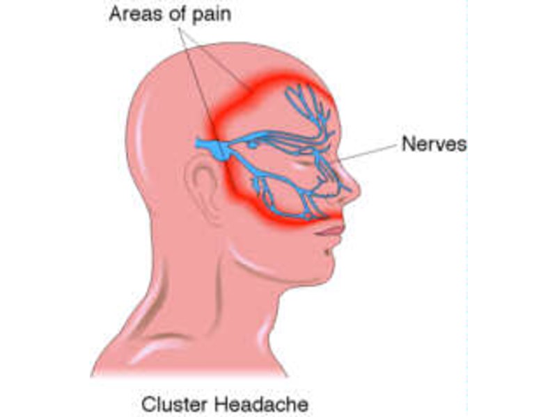 oh-my-aching-head-natural-solutions-to-headache-pain-half-moon-bay