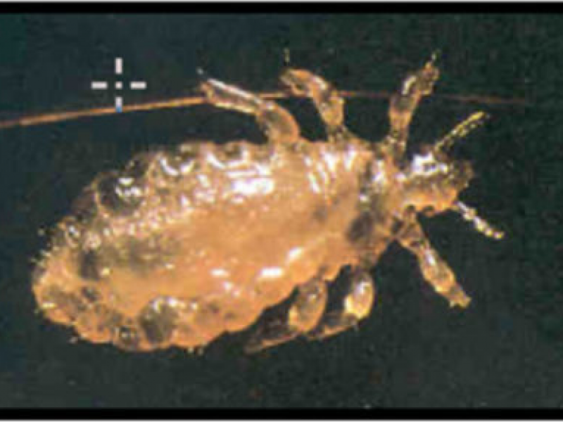 biggest head lice ever found