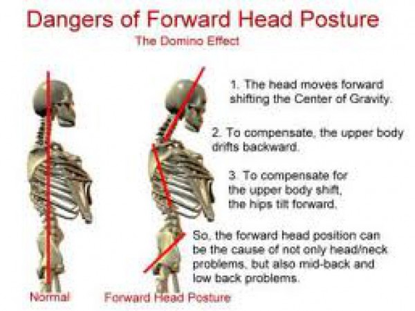 Nagging Upper back/neck pain when sitting...easy ways to improve ...